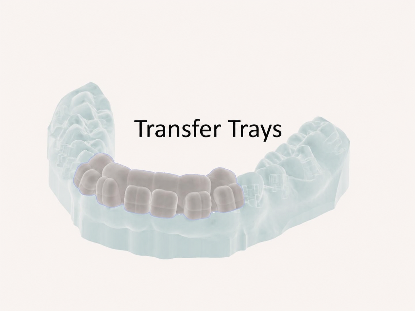 Module 6 - Bracket Transfer trays 
